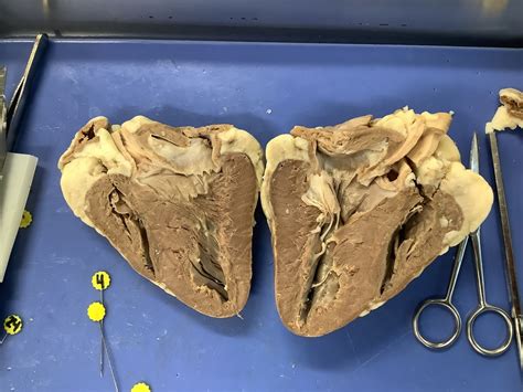Heart Anatomy Dissection Diagram Quizlet