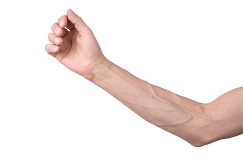 Top 60 Arm Vein Stock Photos Pictures And Images Istock