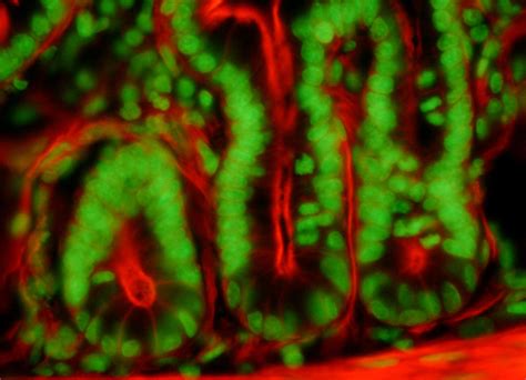 Mouse Intestine Tissue Section with SYTOX Green and Alexa ...