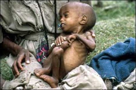 Starving Kids In Africa Starvation In Africa Help Children In