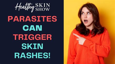 Do Parasites Cause Skin Rashes Jennifer Fugo Youtube