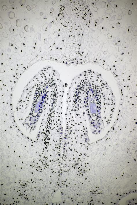Lily Ovary Plant Cells Light Micrograph By Stocksy Contributor