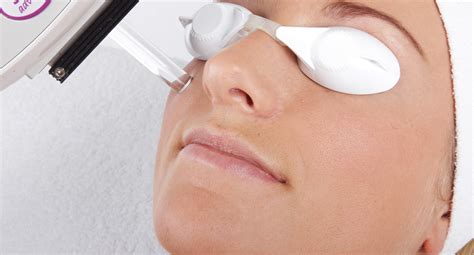 Discover 4 Main Benefits Of Ipl Treatment In London