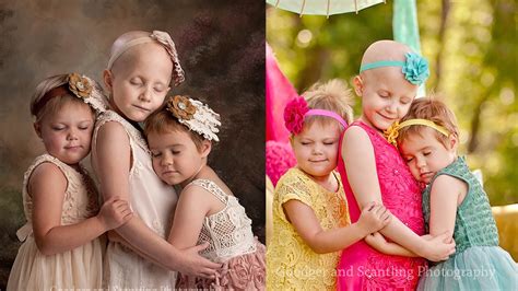 Young Girls Battling Cancer Appear In Stunning Beforeafter Images Abc7 Chicago