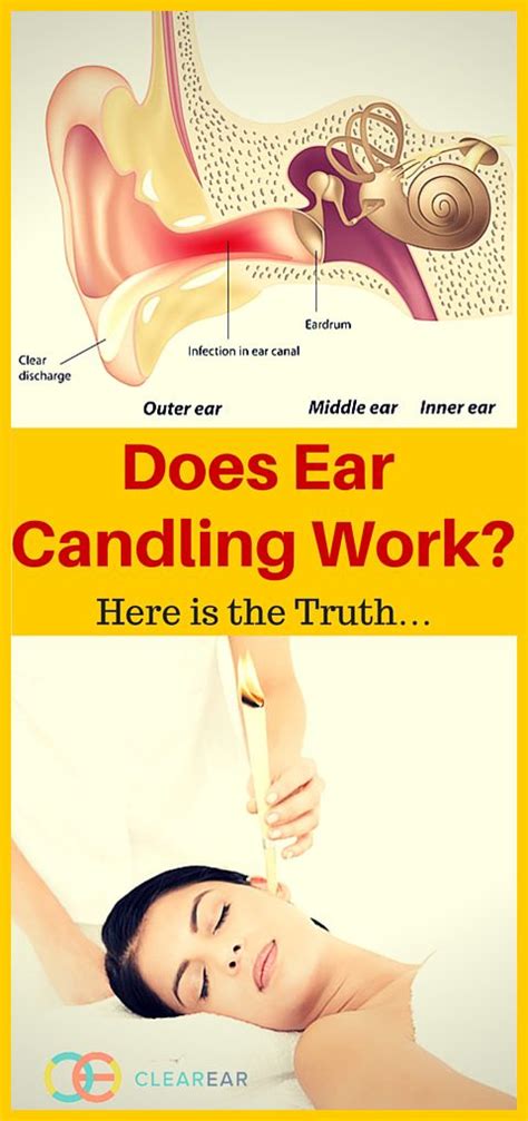 Play for time to delay the outcome of some activity so as to gain time to one's own advantage. Does Ear Candling Work? Here is the Truth… - Clear Ear ...