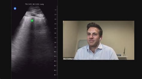 Portable Ultrasound Gives Doctors Remote View Of Patients Lungs Fox