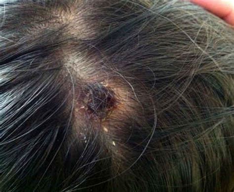 Diabetes, immunological deficiencies) or have conditions (arterial or venous. Maculopapular Rashes Causes (With Pictures)