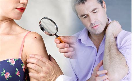 Skin Cancer Symptoms And Signs Four Skin Conditions That Raise Your Risk Of The Disease