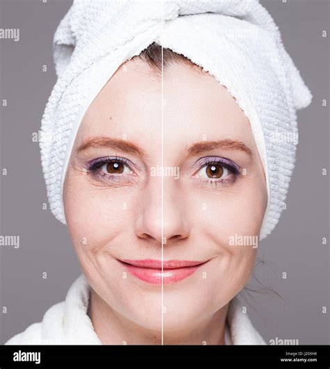 Beauty Concept Skin Care Anti Aging Procedures Rejuvenation
