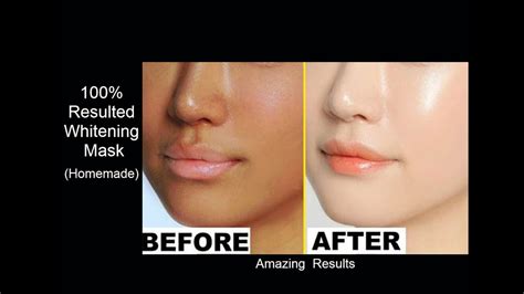 Easy Skin Whitening Mask Recipe Get Fair Skin In One Day Youtube