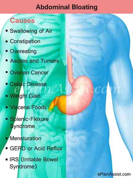 Advanced ovarian cancer causes significant symptoms. Ovarian Cancer Symptoms Bloating Is Stomach Bloated ...