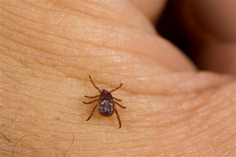 Seed Ticks On Humans Health Hearty