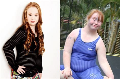 Meet The Young Model Maddy Stuart With Down Syndrome Determined To