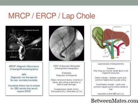 Ercp和mrcp 疾病 2022 华体会app官网app