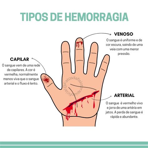 TIPOS DE HEMORRAGIA Anatomia I