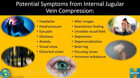 Symptoms And Conditions Of Cervical Spine Compression Causing Internal