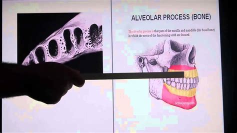 الجزء 3 المحاظرة عن Alveolar Process Bone Youtube