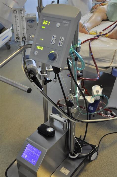 Anatomy ecmo definition indications / contraindications ecmo equipment cannulation types of ecmo cvvhdf. Ecmo, une technique de sauvetage de dernier recours | Site ...