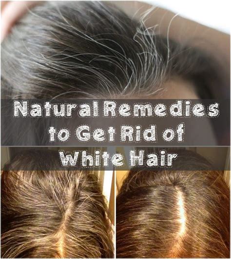 Natural Remedies To Get Rid Of White Hair Dying Your Hair White Hair