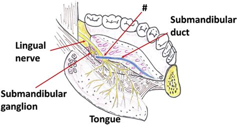 Clinical Anatomy Of The Lingual Nerve A Review Journal Of Oral And