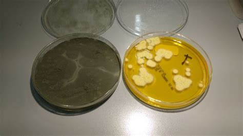 Aspergillus Flavus Front Agar Fungi Agar Bacteria