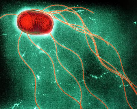Salmonella infection (salmonellosis) is a common bacterial disease that affects the intestinal tract. Salmonella Enteritidis Bacterium Photograph by A. Dowsett ...