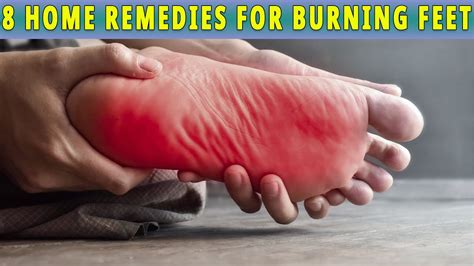 8 Amazing Home Remedies For Burning Feet That Work 100 Youtube