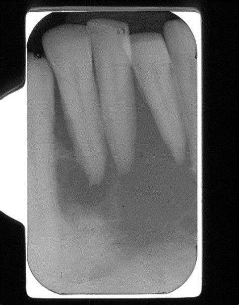 Com October 2012 Diagnosis Uw School Of Dentistry