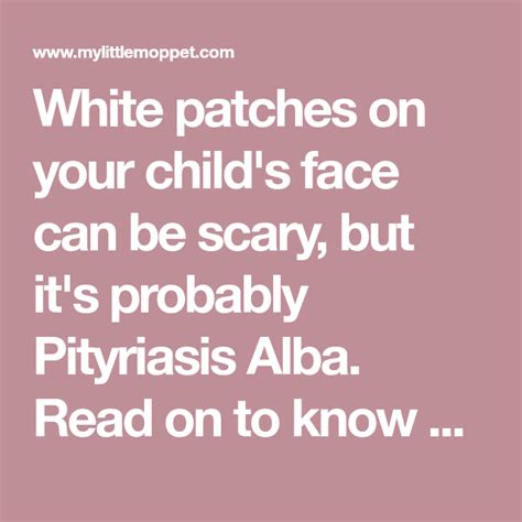 5 Ways To Get Rid Of White Spots On The Face Of Your Child How To Get