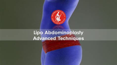 Lipo Abdominoplasty Advanced Techniques Youtube