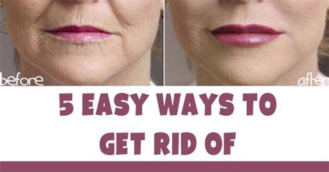 5 Ways To Get Rid Of Wrinkles Around The Mouth Healthytips