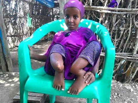 Abukar Sheikh On Twitter Nasra A Little Disabled Somalian Girl
