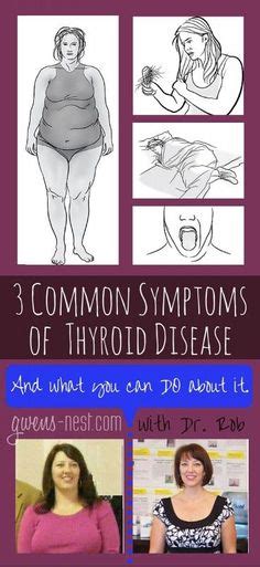 Thyroid Disease Symptoms