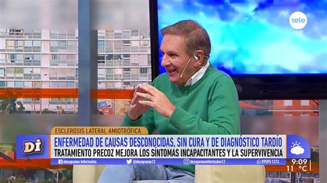 Se origina cuando las células del sistema nervioso llamadas motoneuronas disminuyen gradualmente su funcionamiento y mueren. Esclerosis lateral amiotrófica: tratamiento precoz mejora ...