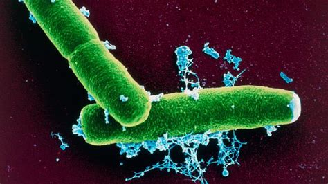 Bbc Earth Our Ancestors May Have Spread Anthrax All Around The World