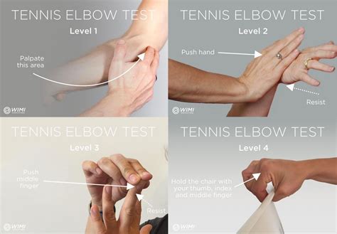 For an acute case of tennis elbow—one that has occurred within the past few weeks— it's important to treat as early as possible. 6 Proven Ways to Test your Tennis Elbow | Tennis elbow ...