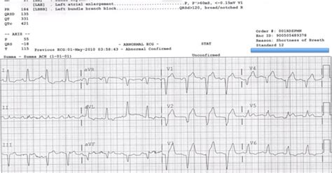 Emergency Cardiac Care Cardiology Ekgs Ecgs Electrocardiography