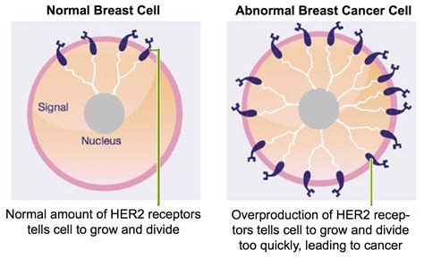 If breast cancer does come back, it's known as recurrence. Xeloda and Tykerb for my Brain Metastases - Cancer Blog