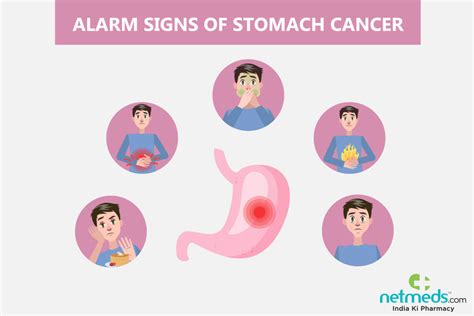 Gastric Cancer Causes Symptoms And Treatment Netmeds
