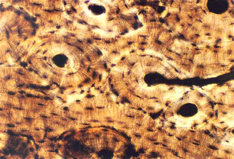 Thin sections are much more common preparing bone/tissue thin sections. COMPACT BONE HISTOLOGY | Microanatomy Web Atlas | Gwen V ...