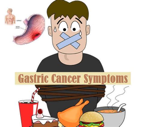 In terms of symptoms, the most obvious one will be a lump just under the surface of the skin which may cause pain when it is touched and could feel fleshy or firm. 15 Gastric Cancer Symptoms Early And Advance Stage ...