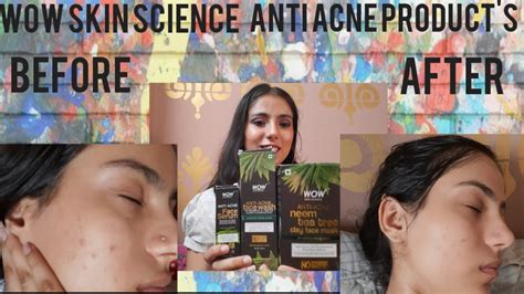 Wow Skin Science Anti Acne Products Review Youtube
