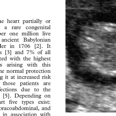 Transverse Sonogram At The Level Of The Chest Demonstrating Protrusion
