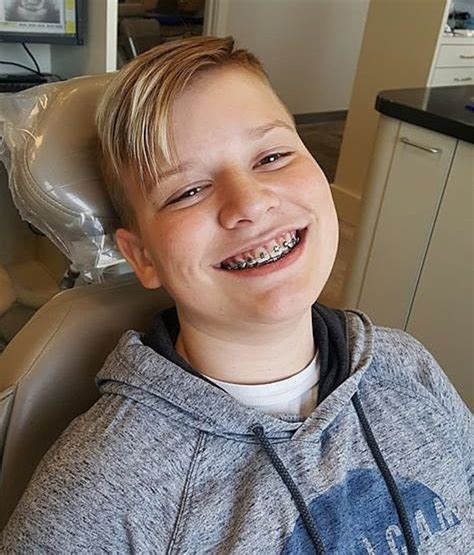 Pin Van John Beeson Op Guys In Braces In