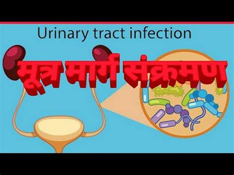 Urinary Tract Infection Uti In Hindi Youtube