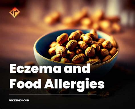 Connection Between Eczema And Food Allergies Wikikenko