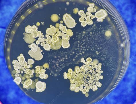Fungal Colonies On Agar Plate Stock Image F0302870 Science Photo