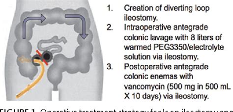 Figure From Diverting Loop Ileostomy And Colonic Lavage An