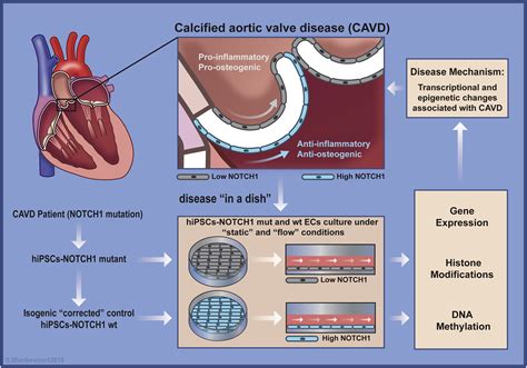 What Endothelial Cells From Patient Ipscs Can Tell Us About Aortic Valve Disease Cell Stem Cell