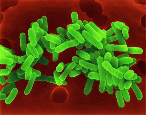 Legionella Pneumophila Photograph By Dennis Kunkel Microscopyscience